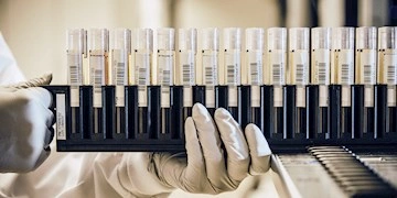 Biological samples
